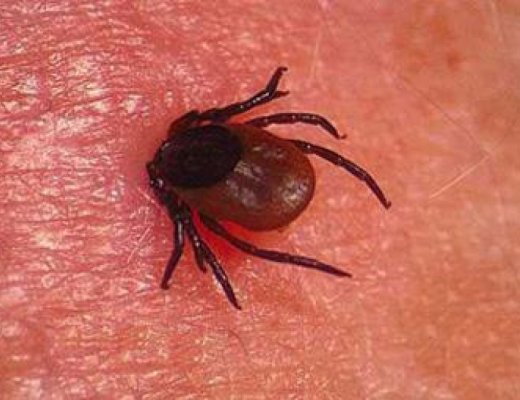 ХАЧИГТ ХАЛДВАРААС сэргийлэх зөвлөгөө